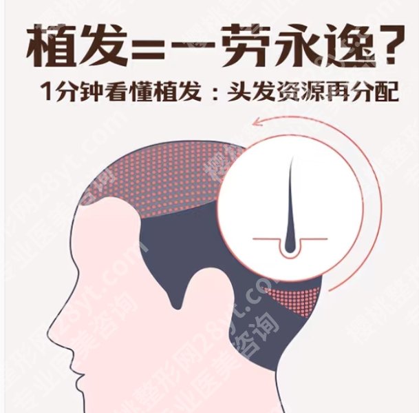 西安植发哪家好?top榜前五排名和价格曝光!(2025下)