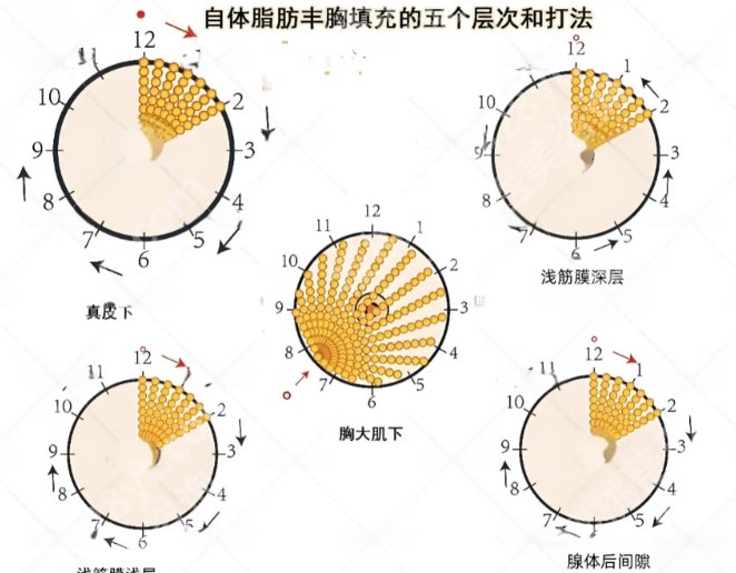 唐志荣医生做隆胸好吗?医生口碑测评|基本资料附上!