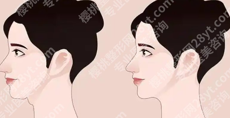 黄大勇颧骨颧弓两件套多少钱?医生擅长项目简介!