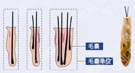 长沙植发医院有哪些?医院技术水平特色!好评如潮