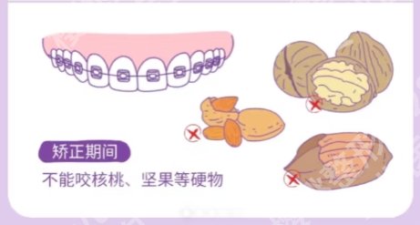北京地包天矫正医院排名公布!推荐几家口碑不错的医院!