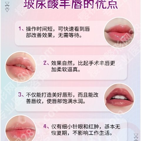 上海玻尿酸丰唇需要多少钱?医院价格表单新鲜出炉!