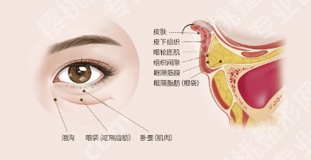 北医三院祛眼袋好吗?医院技术提升!口碑点评