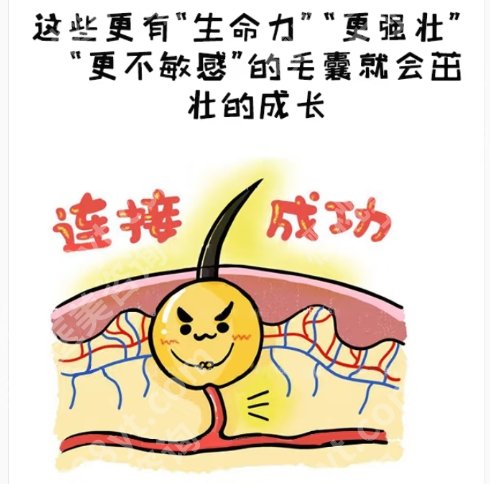 遵义植发哪家医院好?医院技术好声誉高名!价格透明