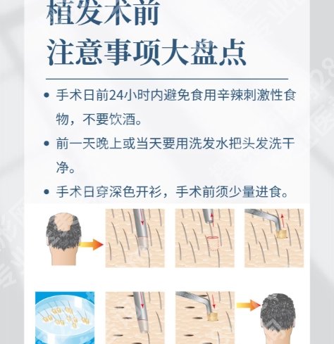 山西植发好的公立医院有哪些?山西白求恩医院|医科大学第一医院值得信赖!