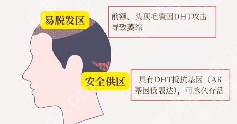 揭阳植发医院哪家医技术好?医院详情介绍!点击查询