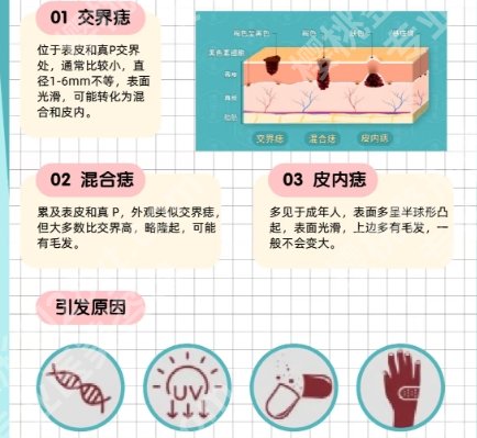 上海九院祛痣价目表更新！医院口碑测评|技术优势介绍！
