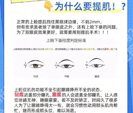 安阳割双眼皮好的正规医院有哪些?医院排行榜名单一览!
