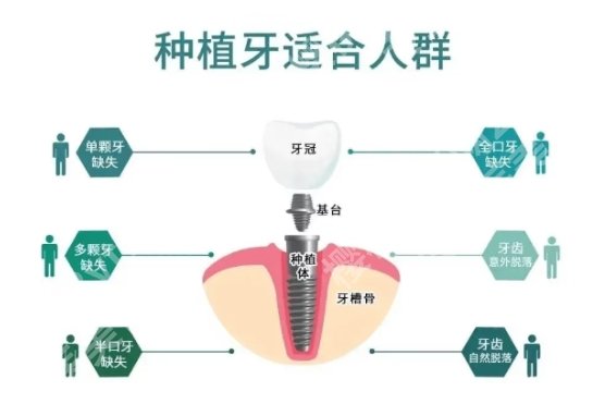 烟台牙齿种植哪家好?烟台毓璜顶医院|烟台山医院|中医医院等技术相对成熟!