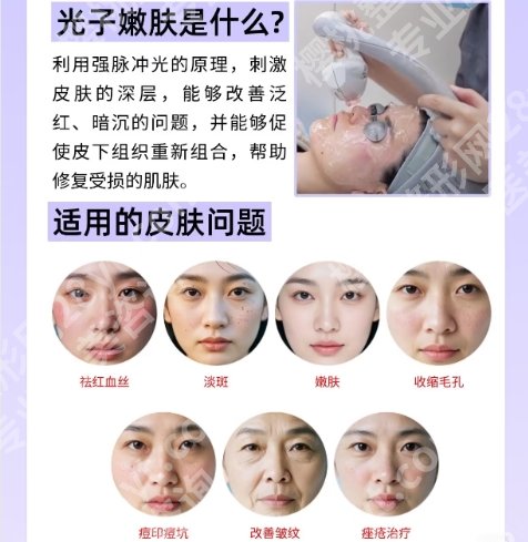 上海华山医院微针一个疗程多少钱？医院人才实力雄厚！