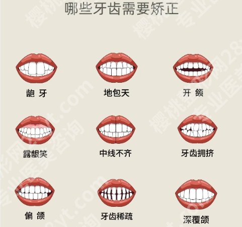 北京儿童医院牙齿矫正需要多少钱?费用一般都是7800元左右起!收藏再看