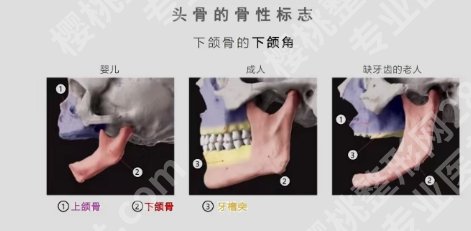 项昌峰和陈小平磨骨谁好?两位实力医生口碑点评!