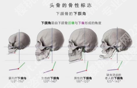 何晋龙医生下颌角磨骨价格贵不贵?收费标准参考!戳进来看