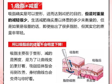 翟爽吸脂怎么样?是知名度很高的一位专家医师哦!收藏再看