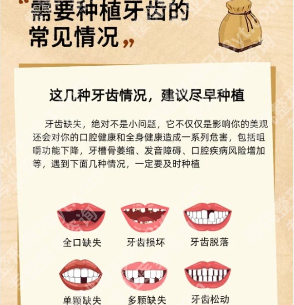 北京牙齿种植好的医生有唐志辉|吴敏节|张强等医生皆在榜上!