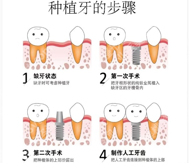 西安牙科医院排名榜10强名单揭秘!基本简介就此告知!