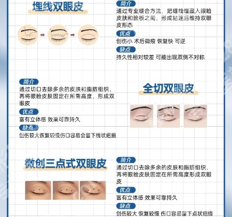 上海割双眼皮哪家正规医院好?医院都是妥妥实力派!
