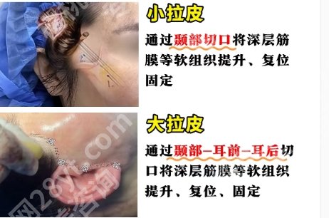 北医三院拉皮医生就很不错!医院擅长项目|医生团队资源!