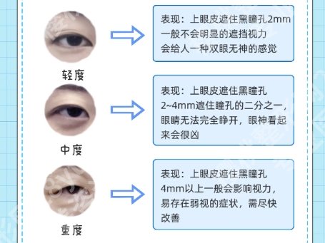 重庆军科双眼皮医生排名!医院整形项目具体介绍!
