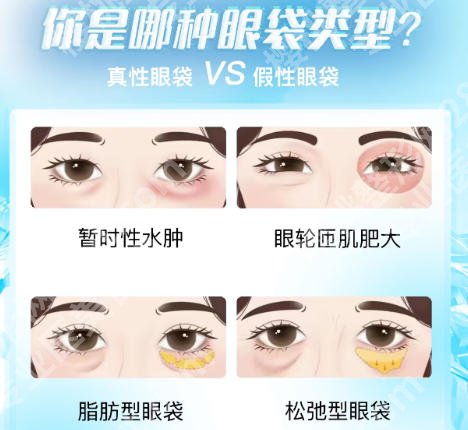 深圳北大医院眼袋手术多少钱?医院医生技术口碑双在线!