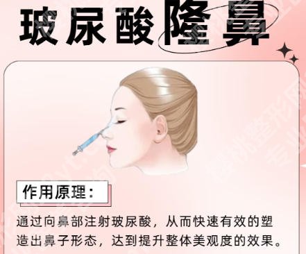 成都军大玻尿酸隆鼻哪个医生好?医院价格明细表一览!