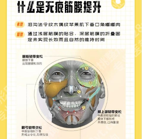 深圳美莱做无痕筋膜哪个医生做得好?医院擅长项目介绍!