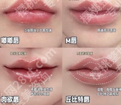 上海玻尿酸丰唇医院哪家好?五家口碑机构等你来选!