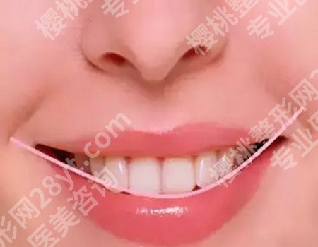 牙齿松动怎么治*好的办法有哪些?亲授实用方法来啦