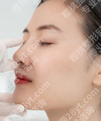 做鼻骨矫正手术什么时间做好?别被心急支配,合适的时候才有合适的结果
