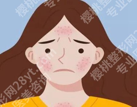 点阵激光3次痘坑全没有了?真实案例+适合痘坑类型,效果实测