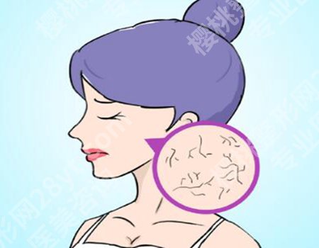 如何面部红血丝?2种有效方法对比,敏感肌快速