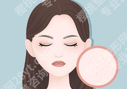 脸部红血丝的方法是什么?4种科学方法,敏感肌快速不反复
