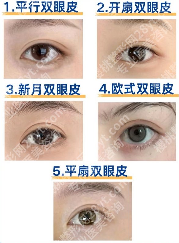 宁波二院双眼皮手术,术前像睁不开眼的社畜|术后变成回头率99%的野生女明星