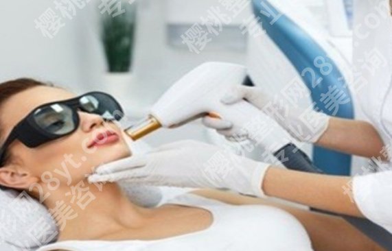 做fotona4D眼睛需要戴护目镜吗?动脸不动眼?护目镜了解一下!