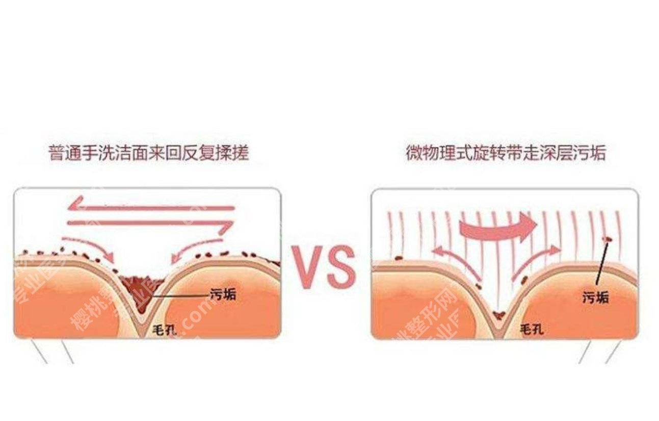微晶磨削术是什么?微晶一上,旧皮靠边站