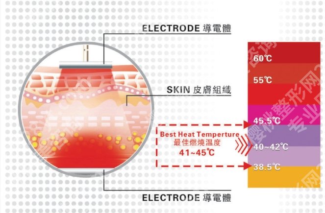 热拉提和水光可以一起做吗?医美常见套餐:热拉提+水光,到底行不行