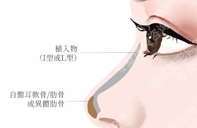 周顺波鼻子案例,鼻子的小改动大不同,给爱美的人又多了一份参考