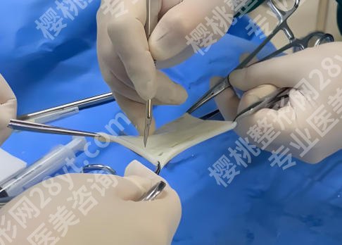 男性生物补片有副作用吗?价格情况和风险信息了解