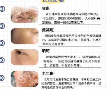 安徽省立医院祛斑可以保多久?收费贵吗?哪位医生好?