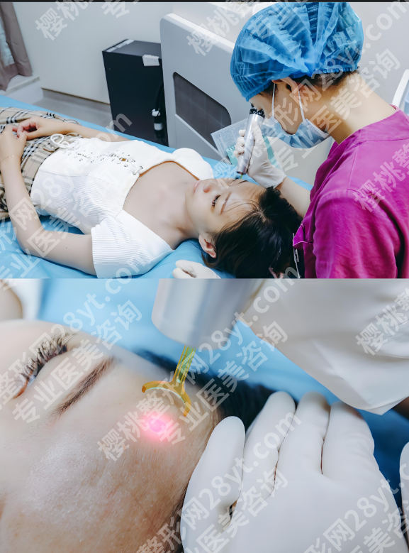 重庆附一院光子嫩肤怎么样?真人案例+挂号攻略,放心冲!