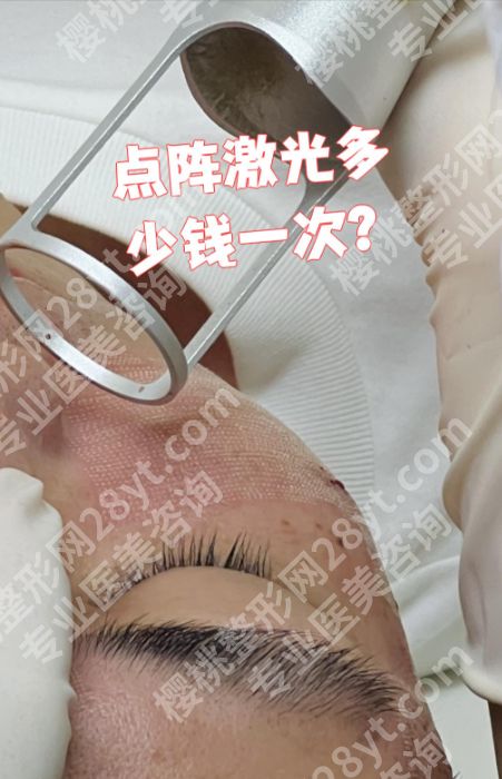武汉第一医院点阵激光多少钱一次?内附真实价目表,看完不花冤枉钱!