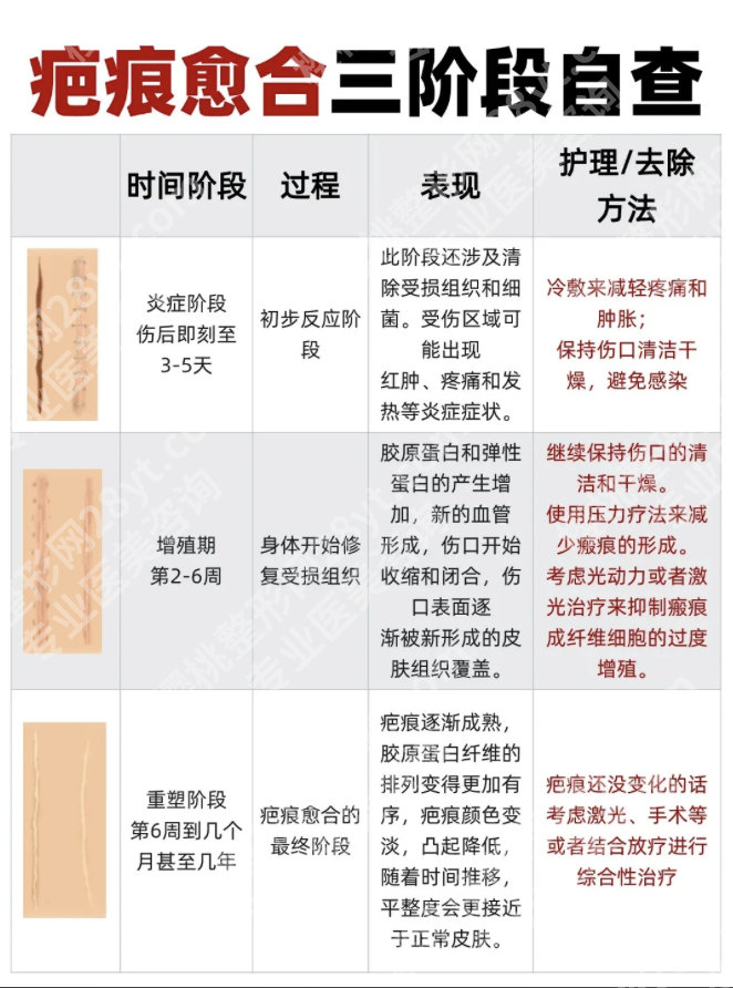 上海华山医院祛疤恢复期多久?三甲医生揭秘3类疤痕的科学修复时间表