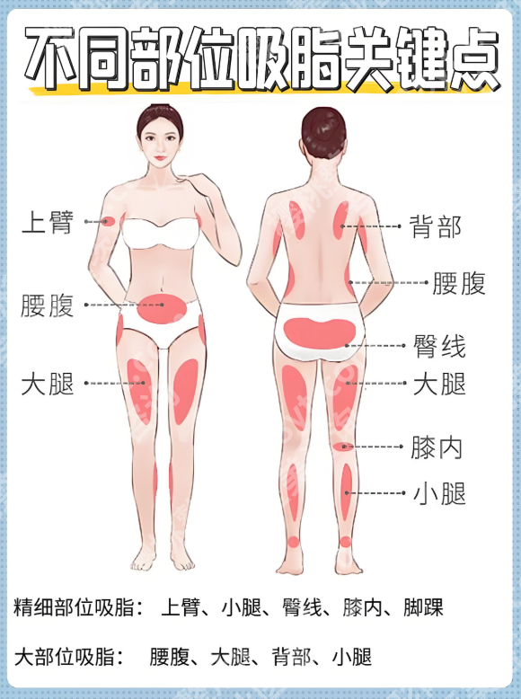 绵阳中心医院抽脂咋样?一篇全解析,真能“一键塑型”不踩坑