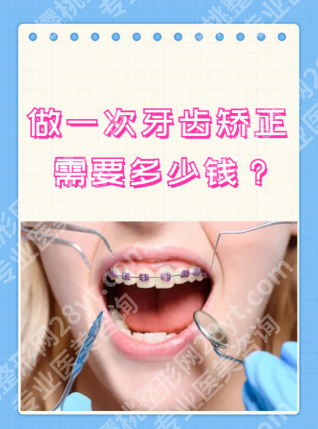 义乌中心医院牙齿矫正多少钱?赶紧来细看费用构成