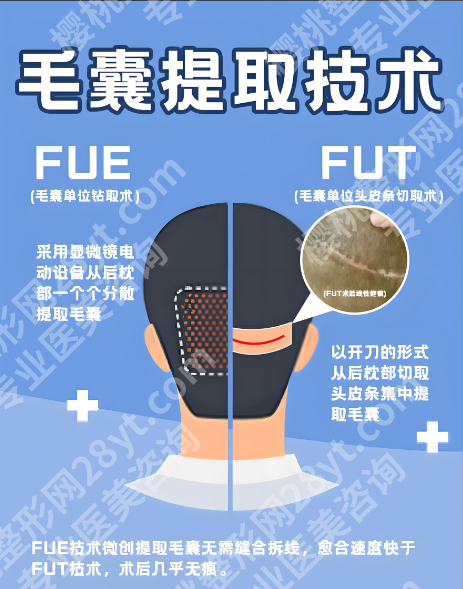 湖南省人民医院植发全解析:从技术到价格,从效果到护理