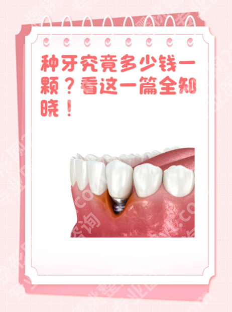 北京医院种牙多少钱一颗?一篇算清“省钱账”!