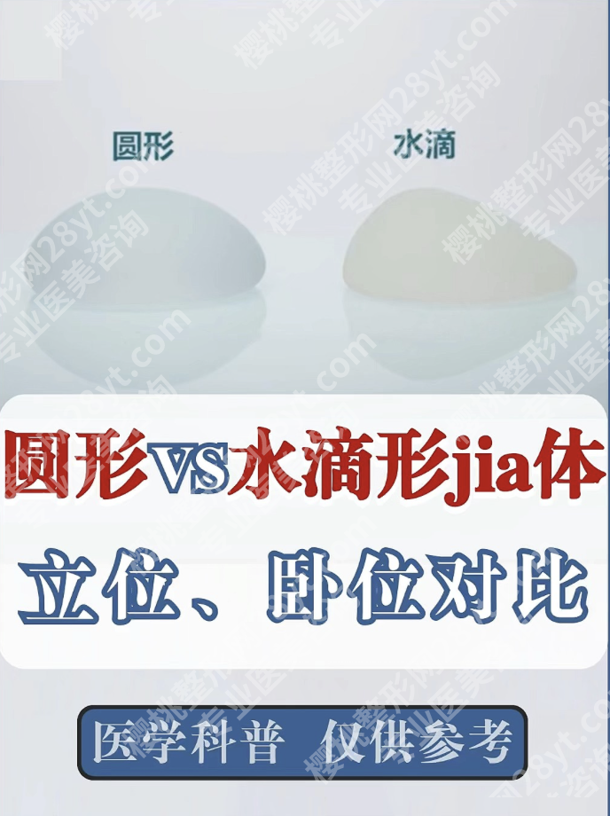 水滴假体和圆形假体哪个好?2025实测对比表+真人案例+选假体攻略