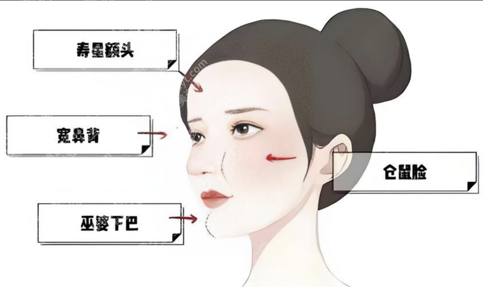 馒化脸修复收紧:从“发面馒头”到自然妈生脸的逆袭指南