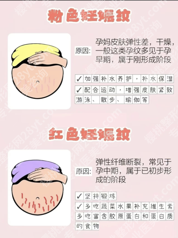 济南妊娠纹修复手术医院怎么选?3类靠谱机构+2 张避坑表,宝妈直接抄作业
