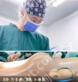 成都丰臀丰垮医美医院推荐:从技术到口碑,帮你找到靠谱机构